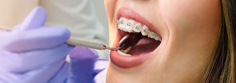 Especialização Em Ortodontia Apcd Associação Paulista Dos Cirurgiões Dentistas